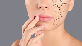 Серый тон, стянутость и высыпания: дерматолог рассказала, как распознать обезвоженную кожу