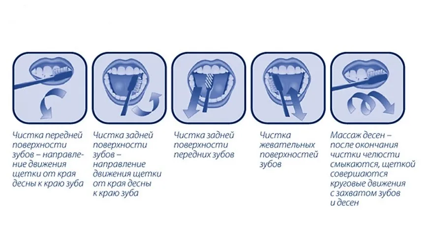 Отбеливание зубов солью. Отбеливание зубов содой. Чистят ли зубы солью. Правила чистки зубов. Отбеливание зубов солью.