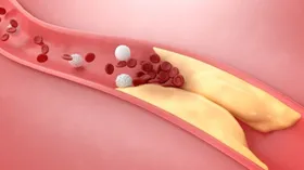 На страже здоровья сердца и сосудов: эти продукты снижают уровень холестерина